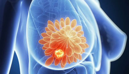 El 19 de octubre, Día Mundial de lucha contra el cáncer de mama