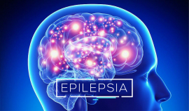 El tratamiento de la epilepsia en Cuba