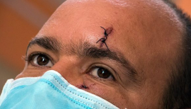 “Nadie podrá arrebatarnos la tranquilidad”: Las historias que deja el odio y la violencia pagada